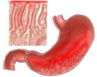 Descrierea gastropatiei eritematoase