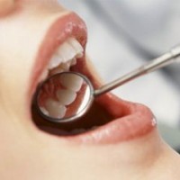 Opriți distrugerea dinților la timp, tratamentul stomatologic