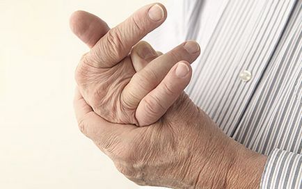 Подагра на руках пальцях, як лікувати, народні засоби, доктор попів (фото), болять суглоби
