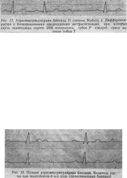 Kézi EKG (tankönyv) - dekódolása EKG