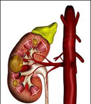 Chistul renal simplu, urologul meu