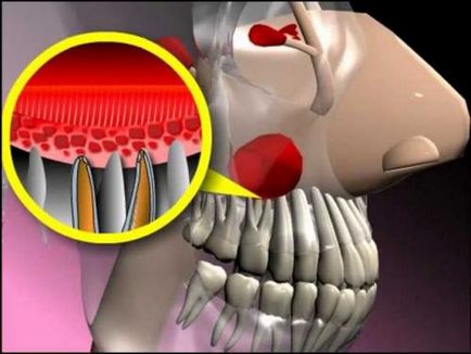 X-ray a sinusurilor nasului (radiografie a sinusurilor nazale) cât de des face, decodare