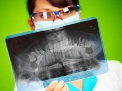 Секрети ендодонтії як повернути до життя мертвий зуб
