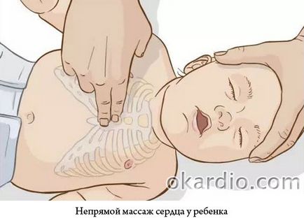 Resuscitarea cardiopulmonară (σλρ) algorithm de acțiuni, indicații