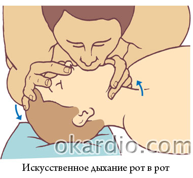 Resuscitarea cardiopulmonară (σλρ) algorithm de acțiuni, indicații