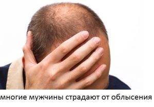 Шампунь проти випадіння волосся, топ 10 найкращих і ефективних шампунів від облисіння - рейтинг,