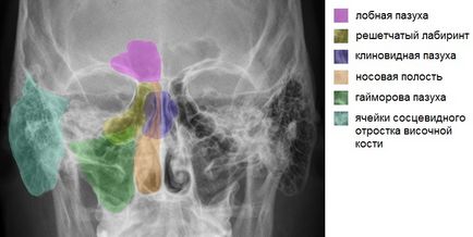 Un instantaneu al nasului care arată radiografia sinusurilor