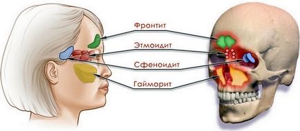 A kép egy fotó az orr, ami azt mutatja, egy X-ray a melléküregek