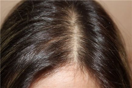 Засоби експерт волосся евалар від випадіння та лупи
