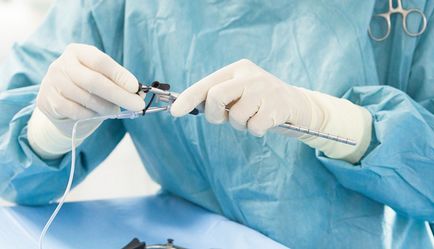 Eltávolítása hipofízis adenoma működési módszerek, a hatások (adenomák) Eltávolítása hipofízisadenómát sebészet, módszerek, következményei