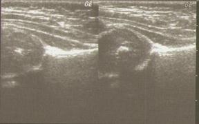 Examinarea cu ultrasunete (uzi) - stadopedie
