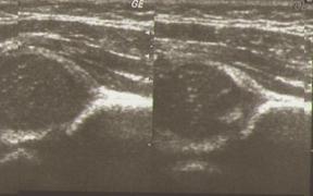Examinarea cu ultrasunete (uzi) - stadopedie