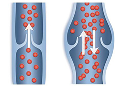 Ultrahang az alsó végtagok központjában Phlebology (Vein) Ultrahang az alsó végtagok központjában Phlebology