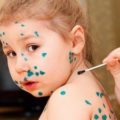 Sudden exanthema viral și enterovirus la semne și fotografii pentru copii