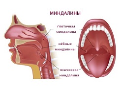 Inflamarea simptomelor linguale ale amigdalelor