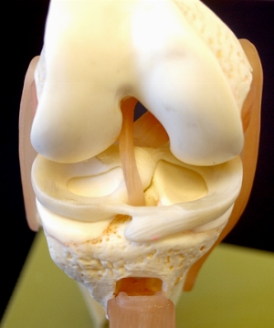Restaurarea cartilajului articulației genunchiului