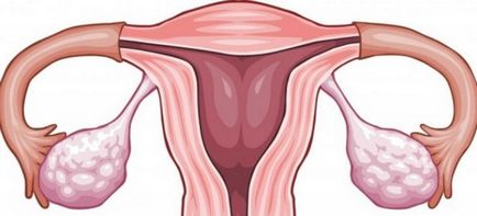 Ovarii la femei