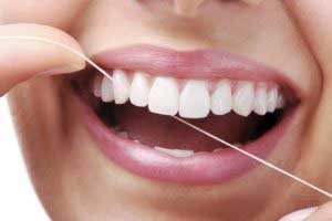 Зубні камені способи їх видалення в домашніх умовах