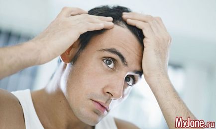 5 Способів попередити випадання волосся у чоловіків - лисуватий чоловік, як зупинити випадіння