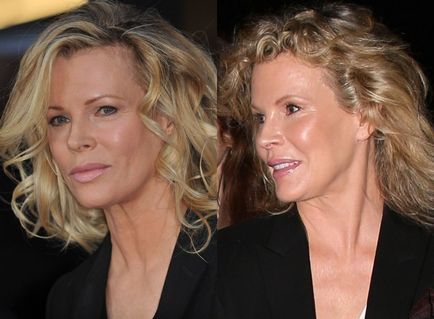 60 éves Kim Basinger és az ő új arca