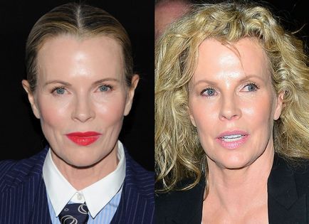 60 éves Kim Basinger és az ő új arca