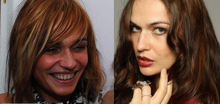 Alena vodonayeva înainte și după plastic, fotografie prezentatorului TV