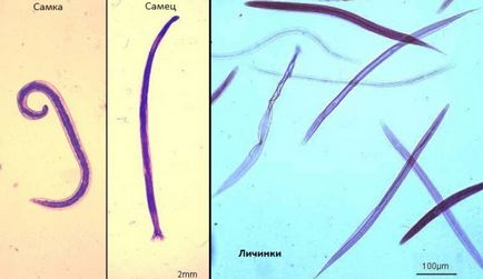 Anchilostomul în viermele de fotografie umană ancylostoma ceylanicum și caninum