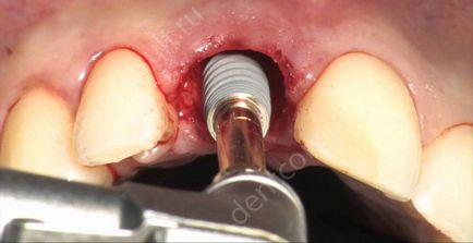 Блог лікаря стоматолога про сучасні методи лікування зубів