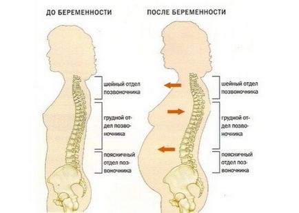 Dureri de spate in timpul sarcinii ce trebuie facut in cazul in care durerile de spate rana in timpul sarcinii