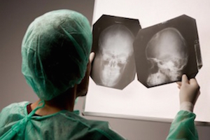 Care este craniografia craniului?