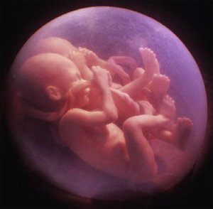 Два жовтих тіла в різних яєчниках або в одному при вагітності і ймовірність многоплодного зачаття