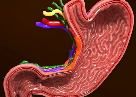 Hyperplasia gyomor fajok, diagnosztizálására és kezelésére - egészségesen élni