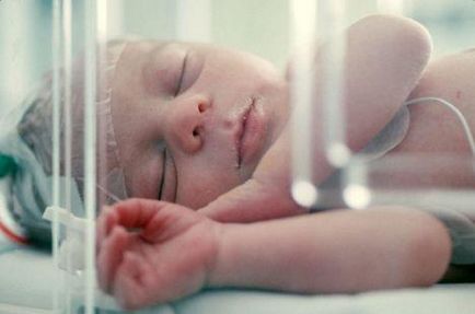 Гіпоксія і асфіксія плода та новонародженого