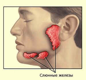 Hyposeivation (oligosyalya, uscăciunea gurii) cauze, tratament, consecințe