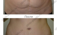 National Center for Plastic Surgery - Hasplasztika