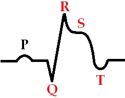 Heart Attack Simptome și tratament