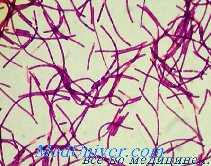 Infecțiile cauzate de bacili (bacillus anthracis, cereus) diagnostic, tratament, prevenire