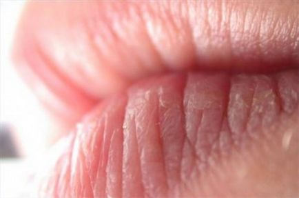 Ce boli sunt pe buzele fotografiei
