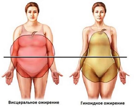 Hogyan működik a szint a női hormonok az elhízás