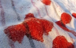 Hogyan lehet szalonnát hagymával pác, Madame meanie - webhelytippeket (főzés lányoknak) Hogyan lehet szalonnát hagymával pác, Madame meanie - webhelytippeket