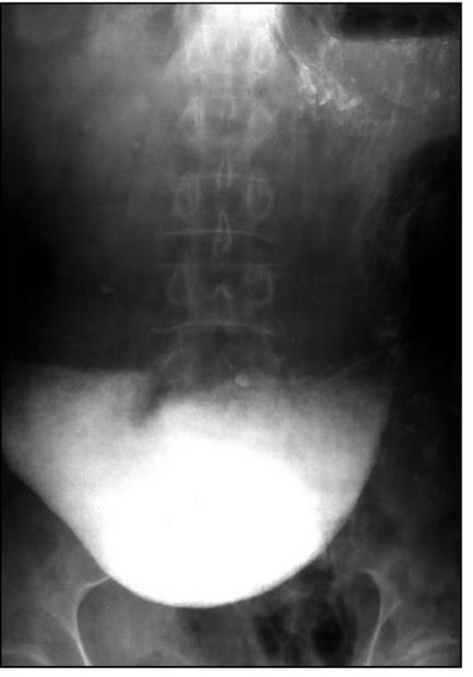 Cardia cântă ceea ce este - ce este incompetența cardiacă a stomacului, reflexul de bază - informații despre sănătate