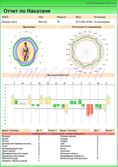 Diagnosticarea diagnostică a organismului prin diagnosticarea cano-3 înainte și după lucrul cu o baghetă magică