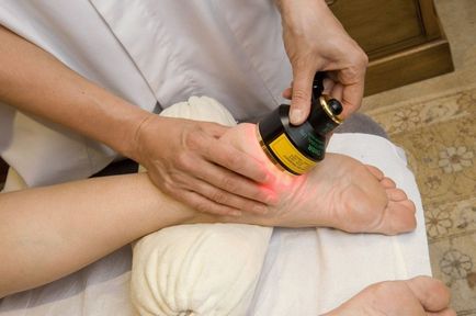 Tratarea picioarelor calcaneale cu un laser, cum este procedura, fotografii înainte și după, recenzii video