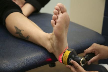Tratarea picioarelor calcaneale cu un laser, cum este procedura, fotografii înainte și după, recenzii video