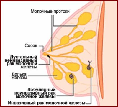 Лікування раку прополісом, блог Галини Лук'янової