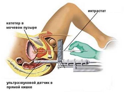 Radioterapia