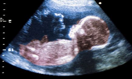 Hogy milyen távon lehet, hogy 3D-s ultrahang terhesség alatt, az ideális én