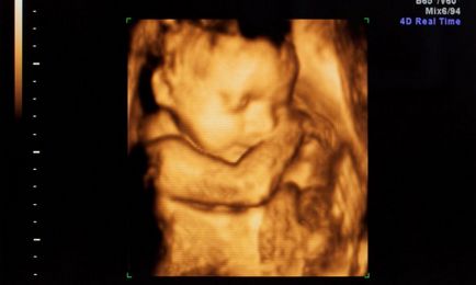 Hogy milyen távon lehet, hogy 3D-s ultrahang terhesség alatt, az ideális én