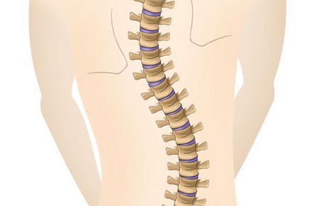 Încălcarea tratamentului postural, prevenirea, LFK, gimnastică, exerciții