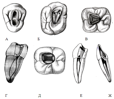 Unele caracteristici ale anatomiei cavității dentare și a canalelor radiculare - dentare Volgograd
